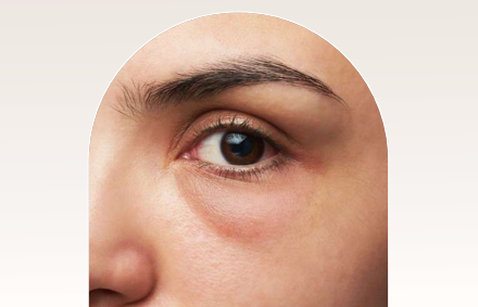 Tendencia Facial Hidro Plastic + Shot de Activo